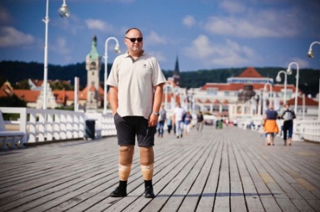 Protezy kończyn dolnych